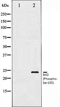 BAD (Phospho-Ser155) antibody