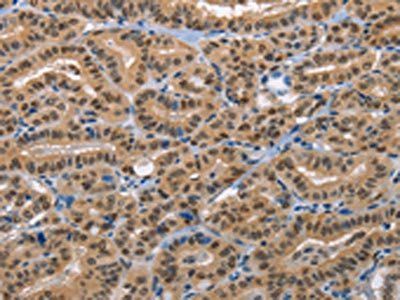 BAG1 Antibody