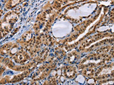 BAG1 Antibody