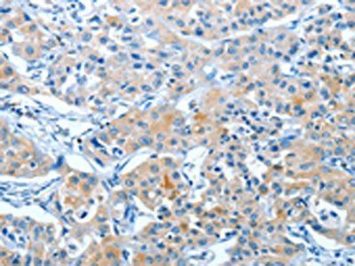 BAG3 Antibody