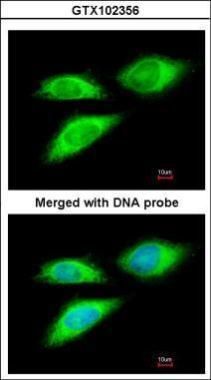 BAG5 Rabbit Polyclonal Antibody