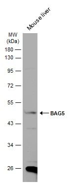 BAG5 Rabbit Polyclonal Antibody