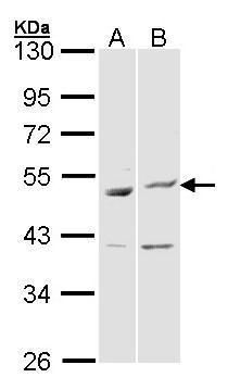 BAG5 Rabbit Polyclonal Antibody