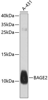 BAGE2 antibody