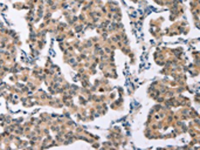 BAI2 Antibody