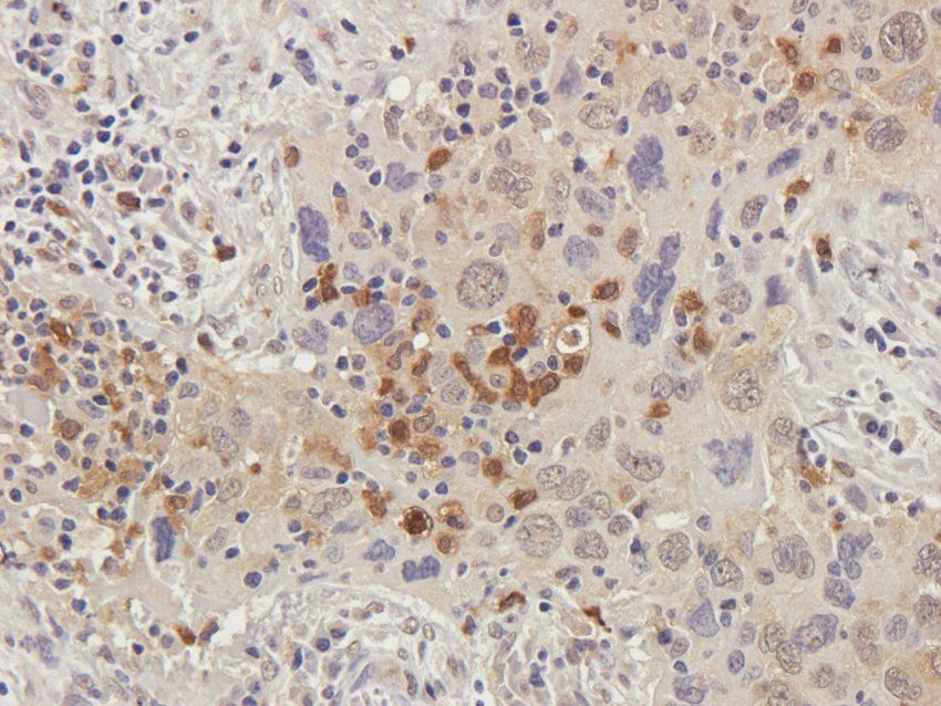 BAIAP2 Rabbit Polyclonal Antibody