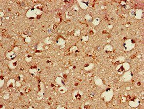 BAIAP2 Antibody
