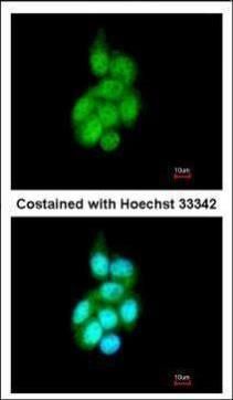 BAIAP2L1 antibody [N1C1]