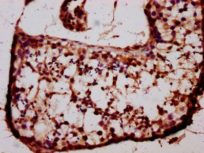 BARHL1 Antibody
