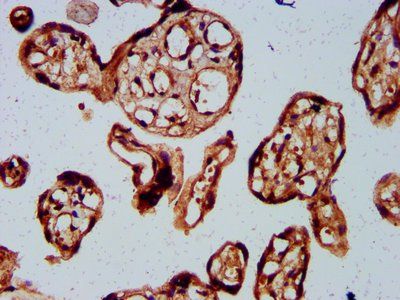 BARHL2 Antibody