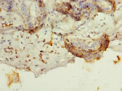 BATF Antibody