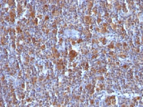 Bax (Apoptosis Marker) Antibody