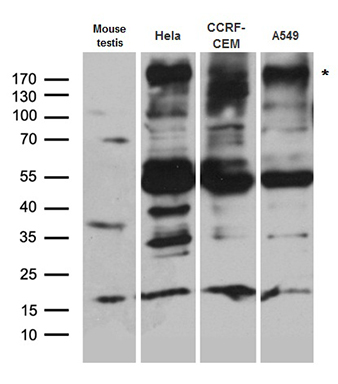 BAZ1A Antibody