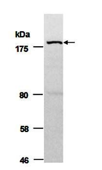 BAZ1b antibody