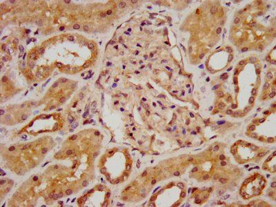 BAZ2B Antibody