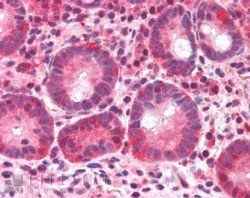 Goat anti-BAZ2B Antibody