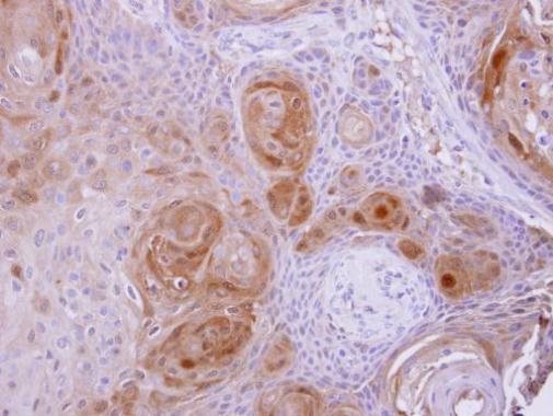 BBOX1 Rabbit Polyclonal Antibody