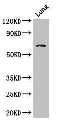 BBS1 Antibody