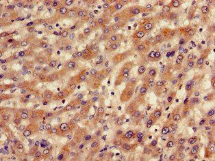 BBS10 Antibody