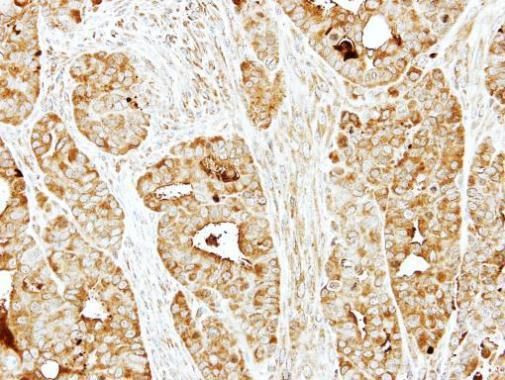 BBS10 antibody [N2C1], Internal