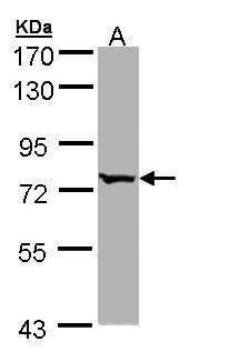 BBS10 Rabbit Polyclonal Antibody