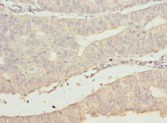 BBS2 Antibody