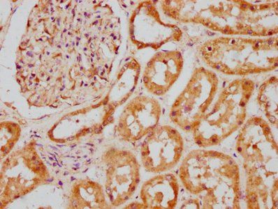 BBS5 Antibody