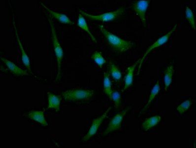 BBS7 Antibody