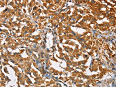 BCAP31 antibody