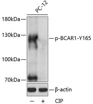 BCAR1 (Phospho-Y165) antibody