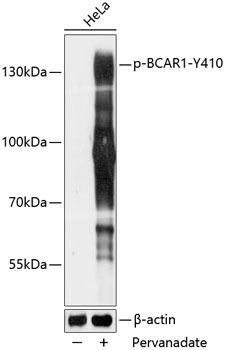BCAR1 (Phospho-Y410) antibody
