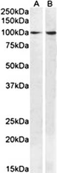 Goat anti-BCAR1 Antibody