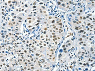 BCAS2 Antibody