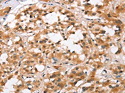 BCAS4 Antibody