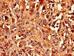 BCAT1 Antibody