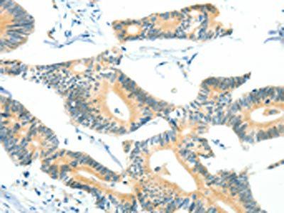 BCAT1 Antibody