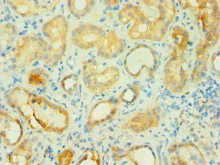 BCAT2 Antibody