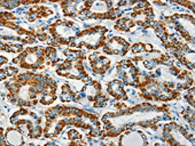 BCAT2 Antibody