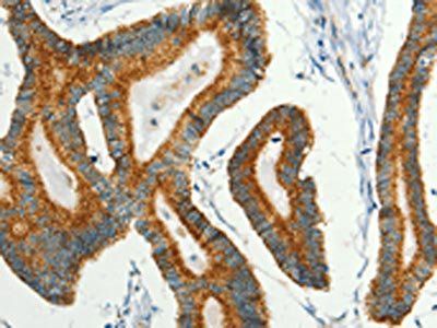 BCAT2 Antibody