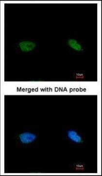 BRCA2 and CDKN1A interacting protein Antibody