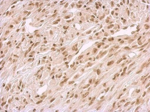 BCCIP Rabbit Polyclonal Antibody