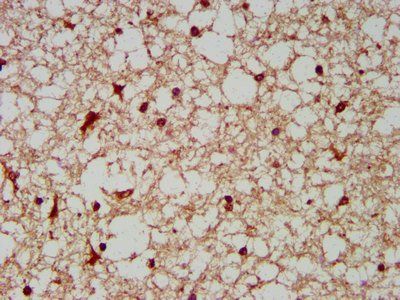 BCKDHA Antibody