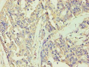 BCKDK Antibody