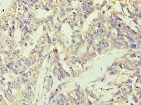 BCKDK Antibody
