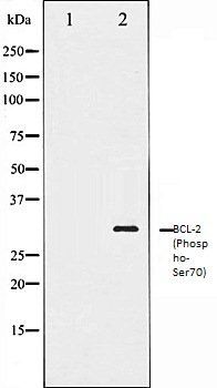 BCL2 (Phospho-Ser70) antibody