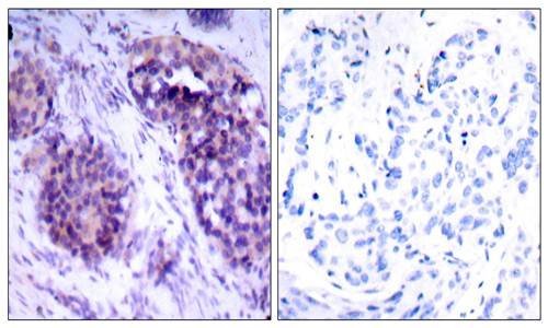 BCL-XL (Phospho-Ser62) Antibody