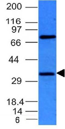 BCL10 (MALT-Lymphoma Marker) Antibody