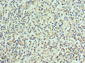 BCL11A antibody