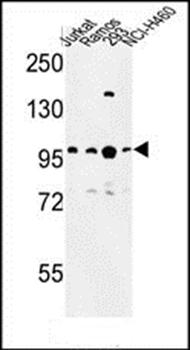 BCL11A antibody