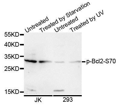BCL2 (phospho-S70) antibody